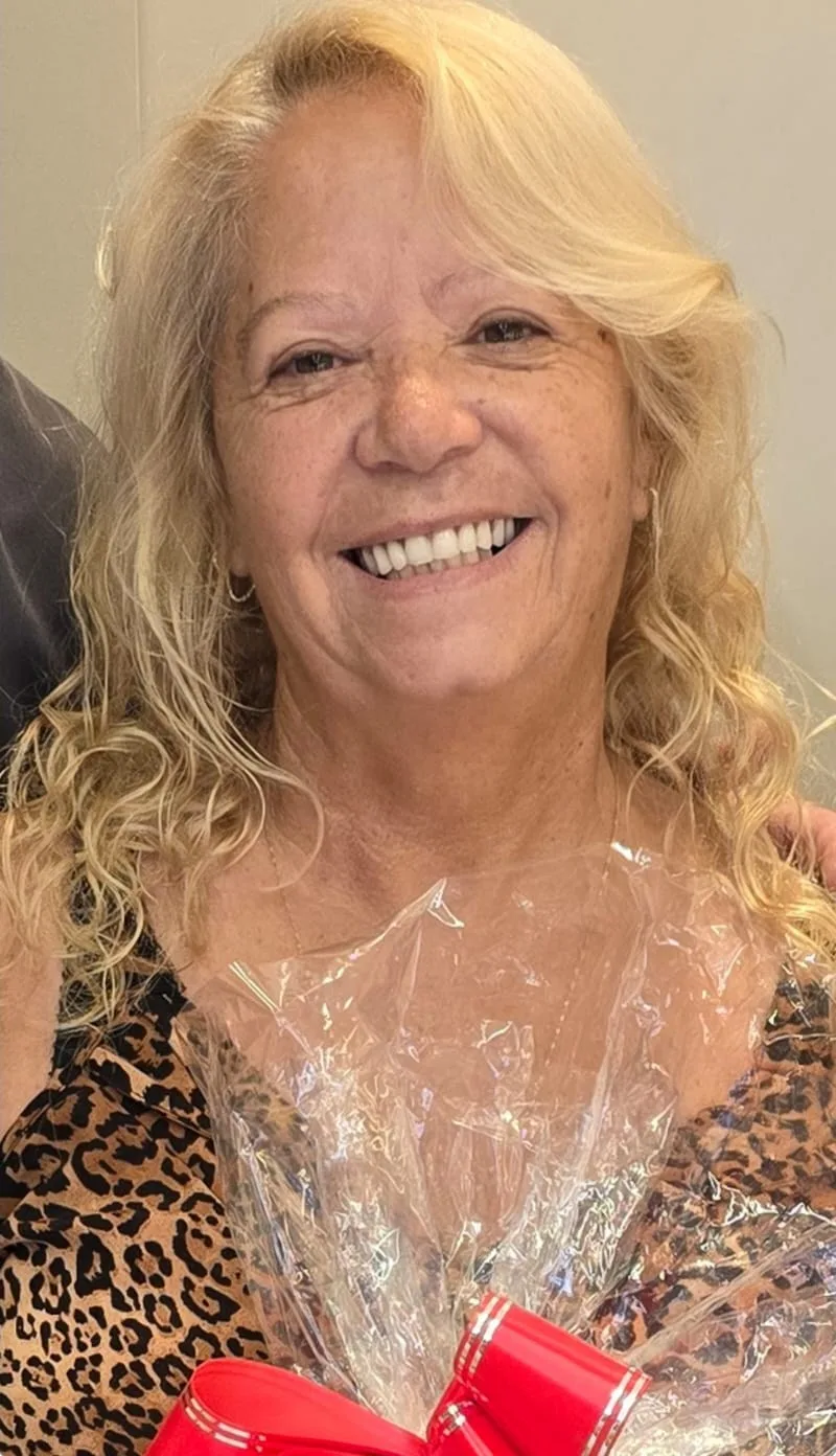 Depois — caso 1